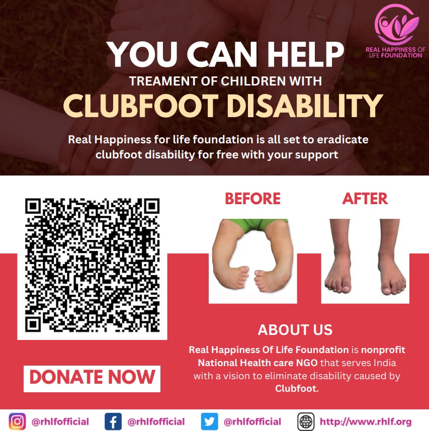 Elimination of clubfoot poster